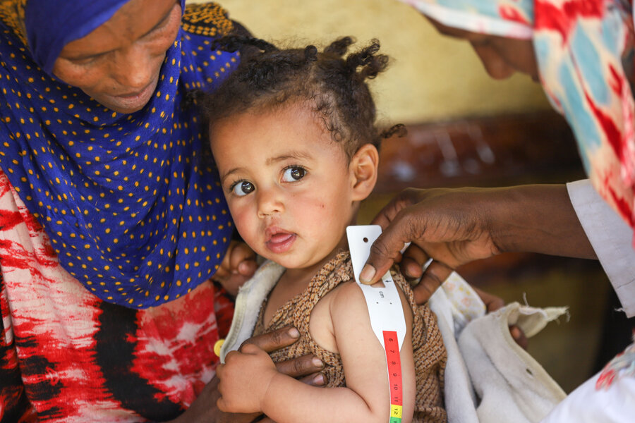 One-year-old Lihan Ali Hassen is tested for malnutrition at a health post in Ethiopia's Amhara region. Her family has endured hunger and hardship, mother Hayat Abate says. Photo: WFP/Michael Tewelde